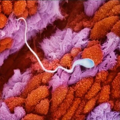 Сперматозоид в маточной трубе. Фотографии ©Lennart Nilsson