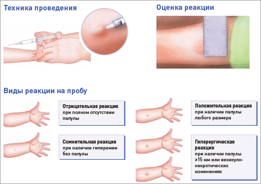 Процедура проведения теста