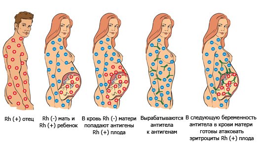 Доклад по теме Резус-конфликт между матерью и плодом