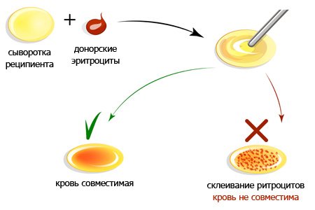 Совместимость групп крови