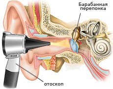 Осмотр отоскопом