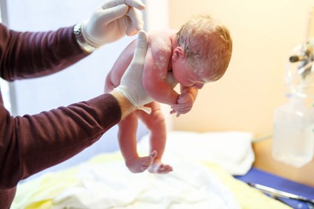 Шкала АПГАР: оценка новорожденных в баллах