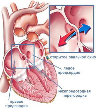 Открытое овальное окно