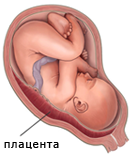 Боковое предлежание плаценты