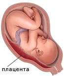 Краевое предлежание плаценты