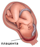 Полное предлежание плаценты