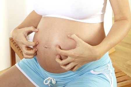 Кожный зуд во время беременности