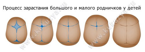 Процесс зарастания большого и малого родничков у детей