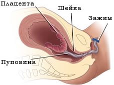 Послед