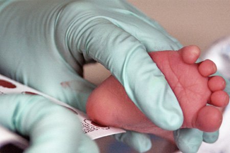 Скрининг новорождённых. Забор образцов крови